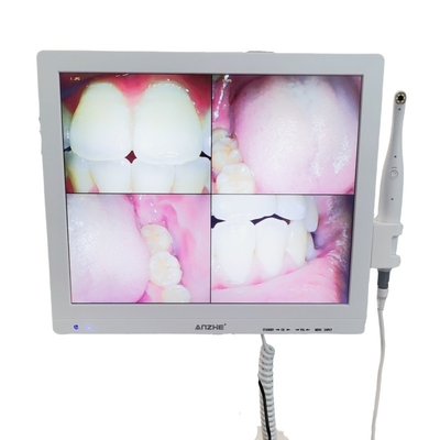 Wifi tout en un appareil photo oral avec haut-parleur écran LCD scanner de caméra orale dentaire