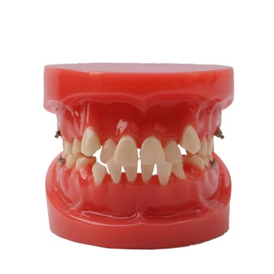Formation à l'utilisation des dents Dentistique Modèle d'enseignement Modèle d'orthodontie dentaire fonctionnelle sans support