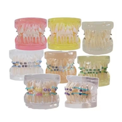 Modèle de dents humaines multicolores pour étude Modèle de dents orthodontiques dentaires avec support