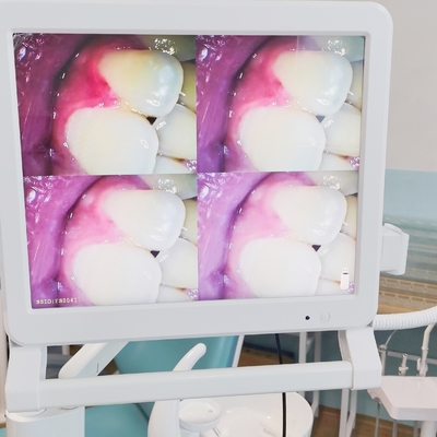 Endoscope dentaire avec moniteur Wifi portable avec appareil photo portable Endoscope intra-oral