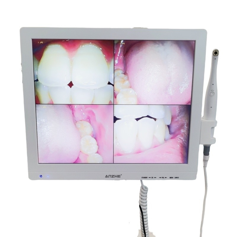 Wifi tout en un appareil photo oral avec haut-parleur écran LCD scanner de caméra orale dentaire