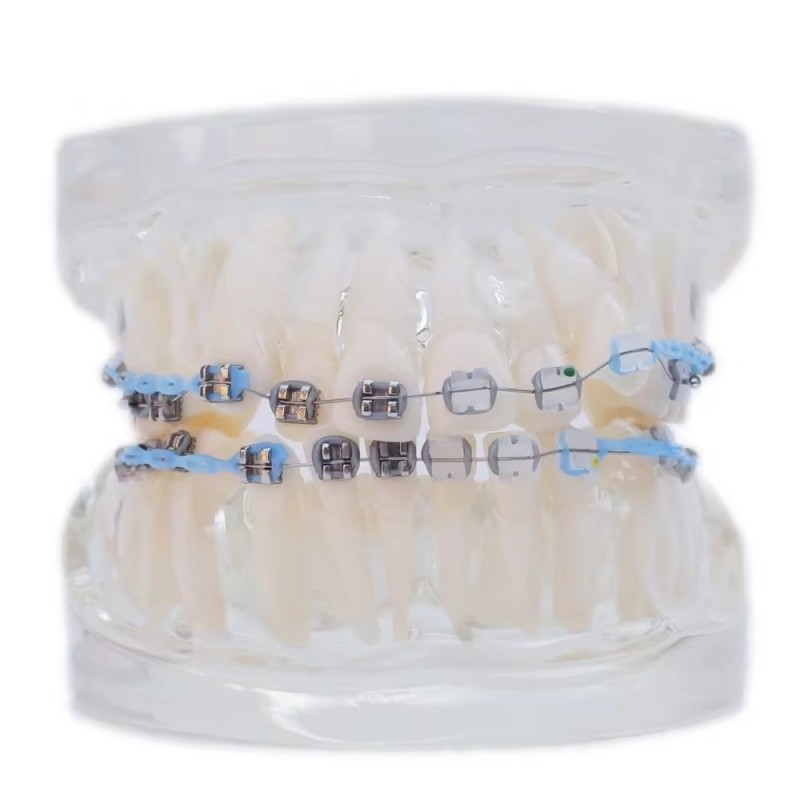 Modèle de dents humaines multicolores pour étude Modèle de dents orthodontiques dentaires avec support